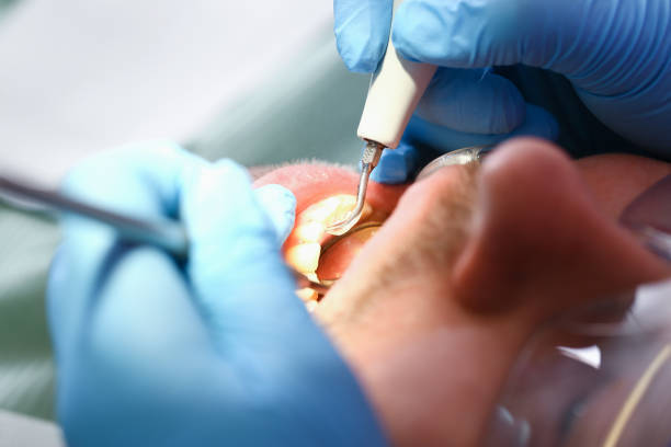Best Orthodontic Emergency Dentist in Fairbanks Ranch, CA